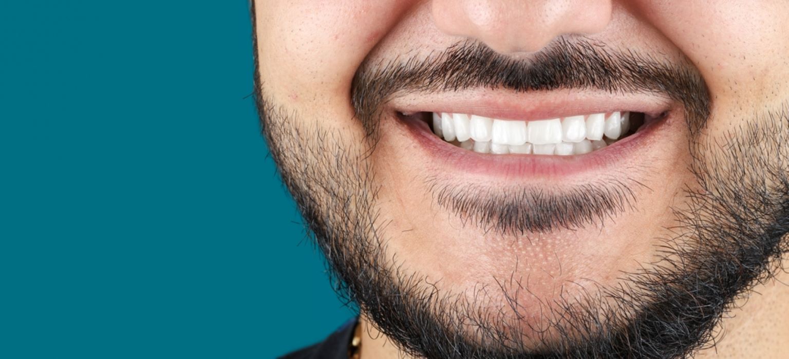choosing between dental implants and veneers a complete guide